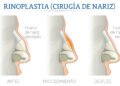 Dificultades respiratorias: causas y soluciones más allá del resfriado