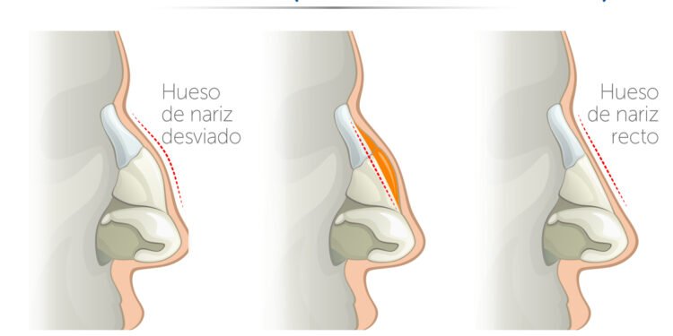 Dificultades respiratorias: causas y soluciones más allá del resfriado
